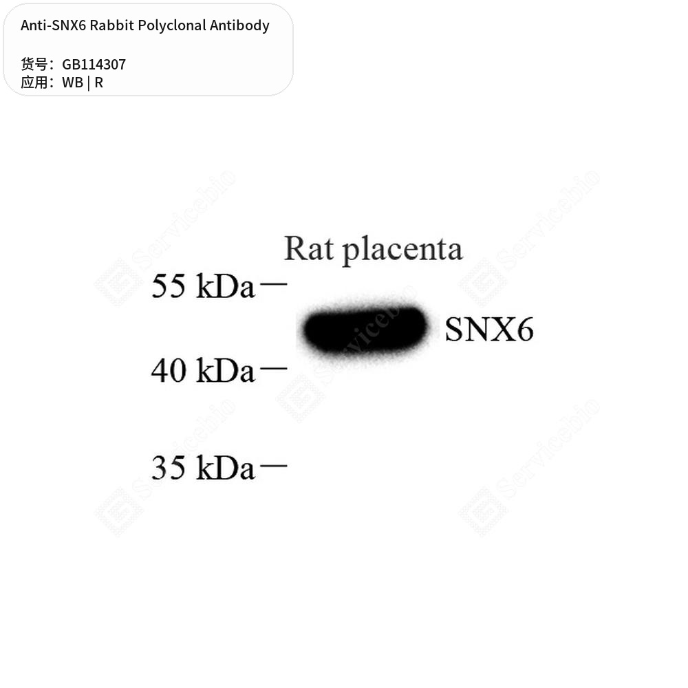 Антитела первичные, поликлональные кролика к SNX6 крысы, 50 мкл