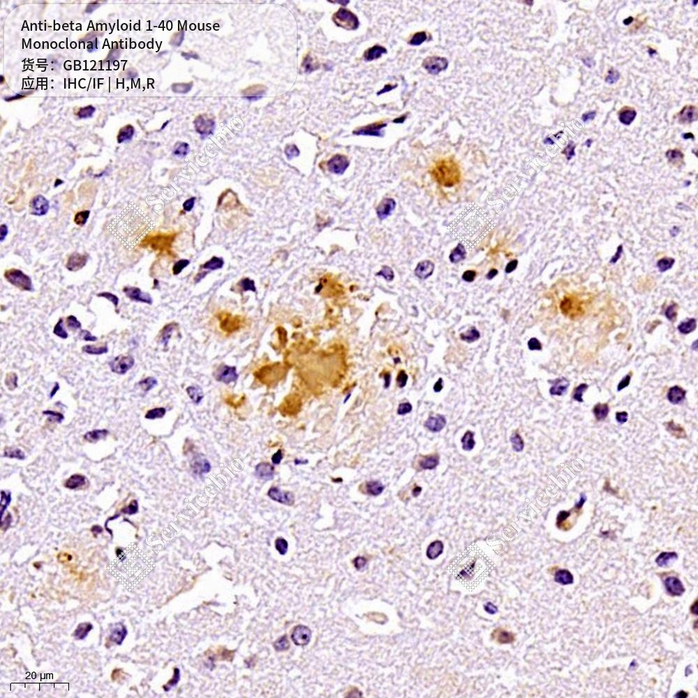 Антитела первичные, моноклональные мыши к beta Amyloid 1-40 крысы, мыши, человека, 50 мкл