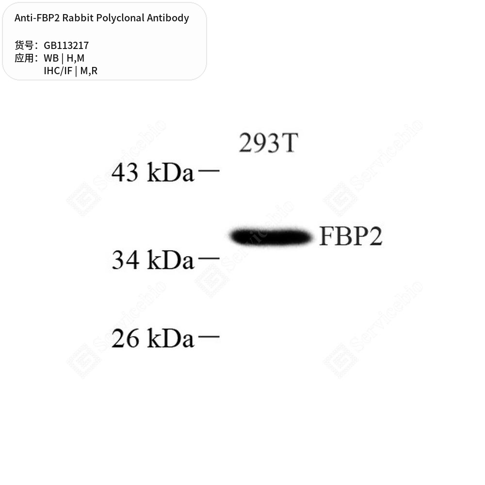 Антитела первичные, поликлональные кролика к FBP2 крысы, мыши, человека, 100 мкл