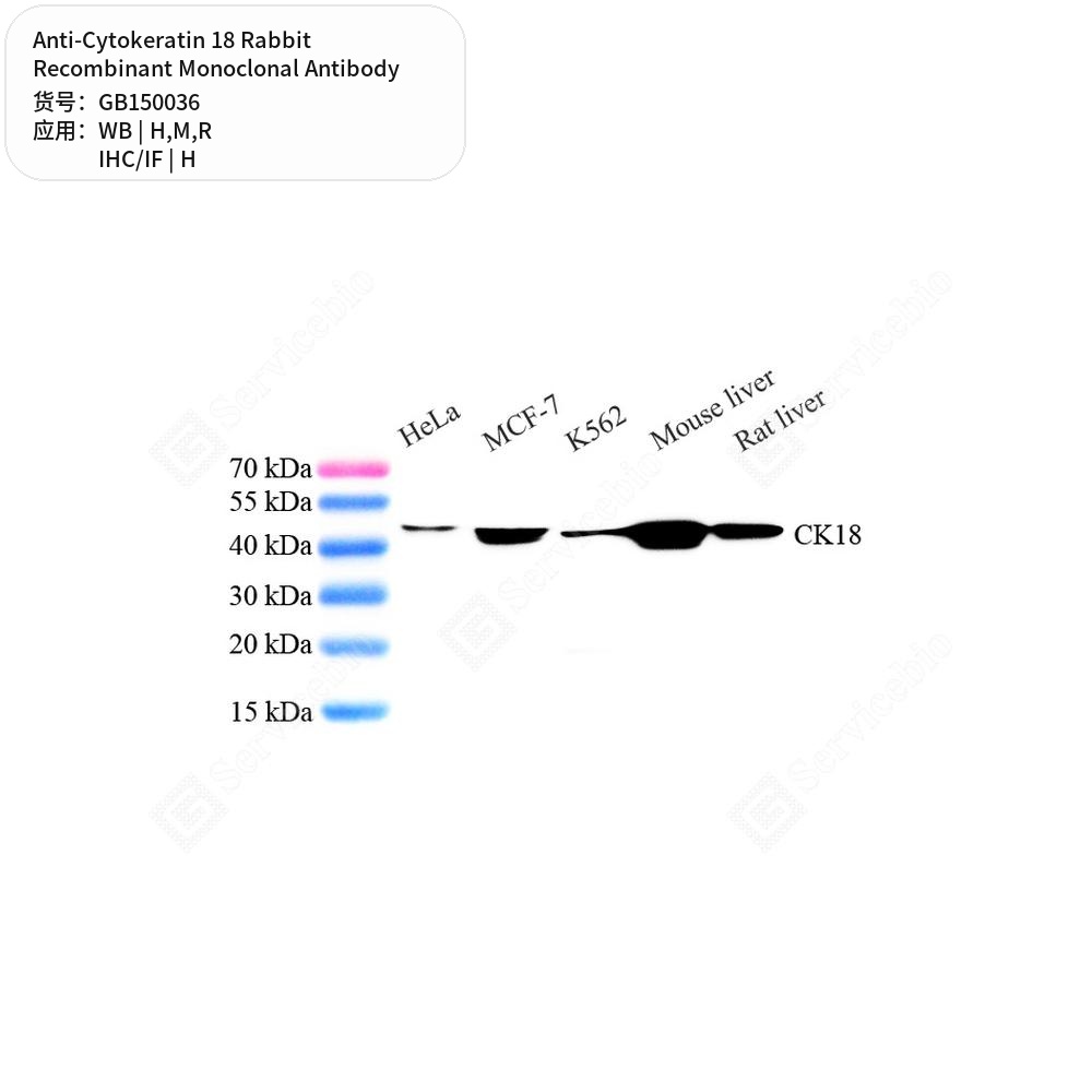 Антитела первичные, моноклональные кролика к Cytokeratin 18 крысы, мыши, человека, 50 мкл