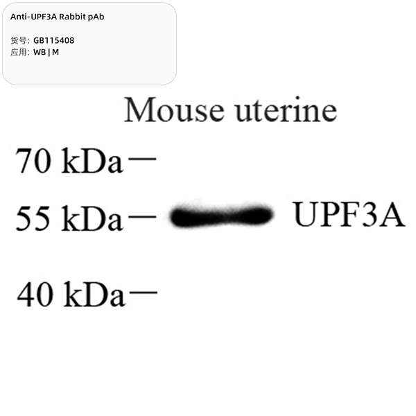Антитела первичные, поликлональные, UPF3A, 100 мкл