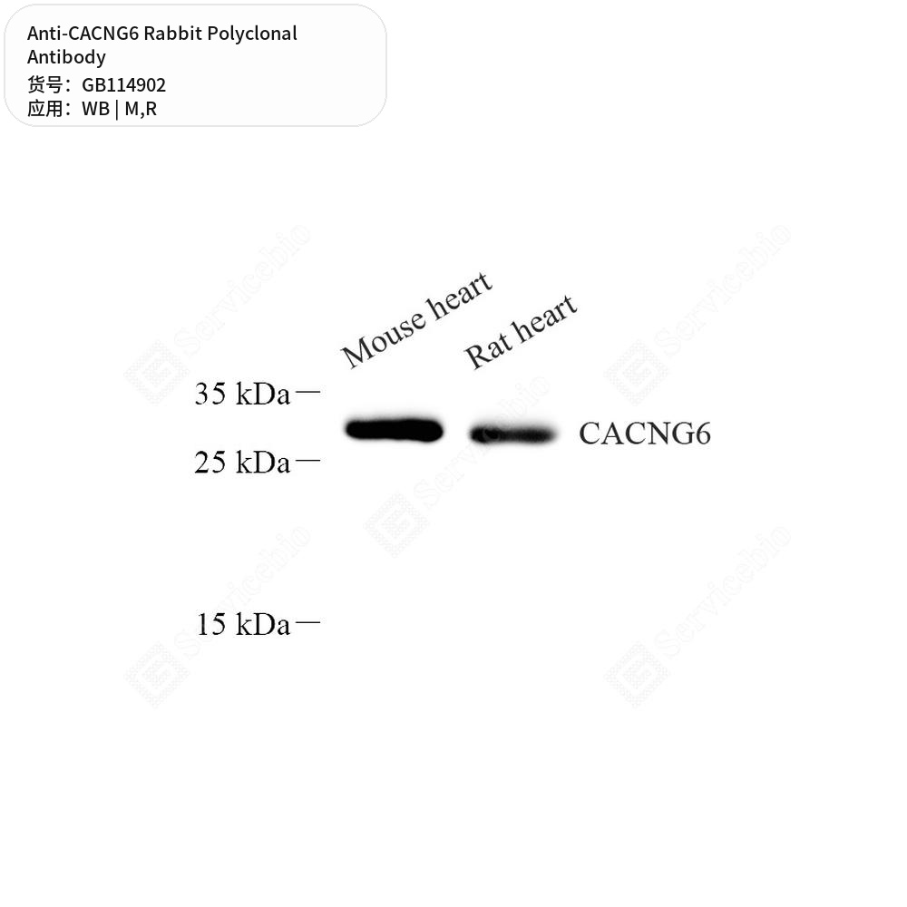 Антитела первичные, поликлональные кролика к CACNG6 крысы, мыши, 50 мкл