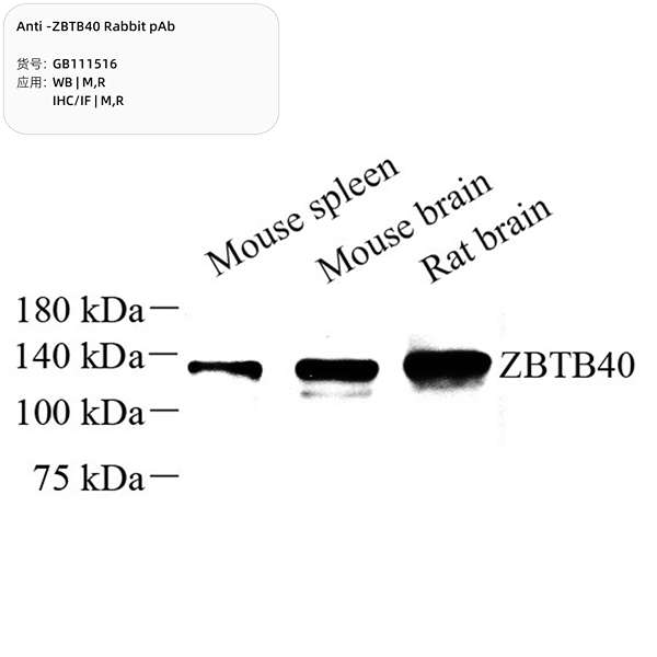 Антитела первичные, поликлональные, ZBTB40, 100 мкл