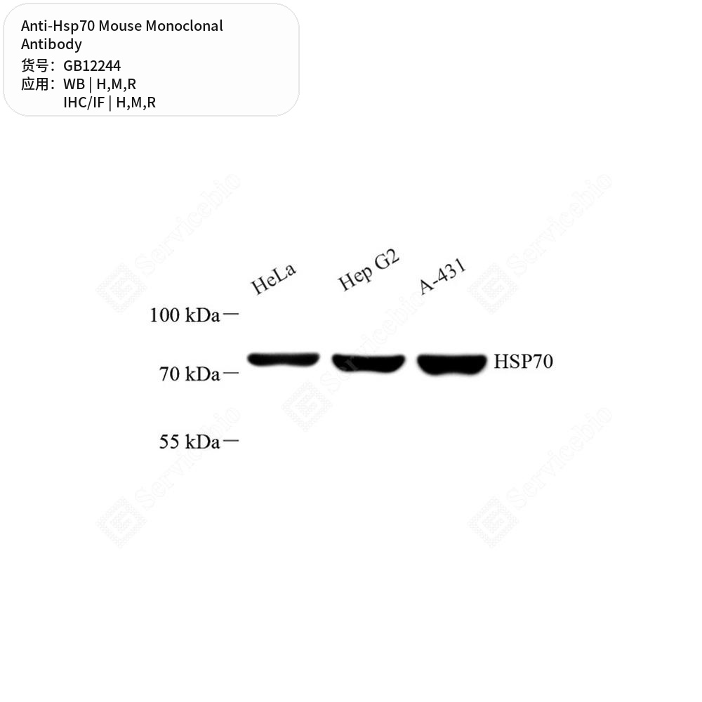 Антитела первичные, моноклональные мыши к Hsp70 крысы, мыши, человека, 50 мкл