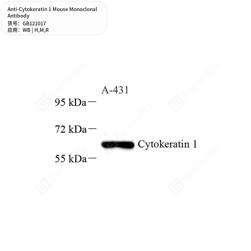 Антитела первичные, моноклональные мыши к Cytokeratin 1 крысы, мыши, человека, 50 мкл