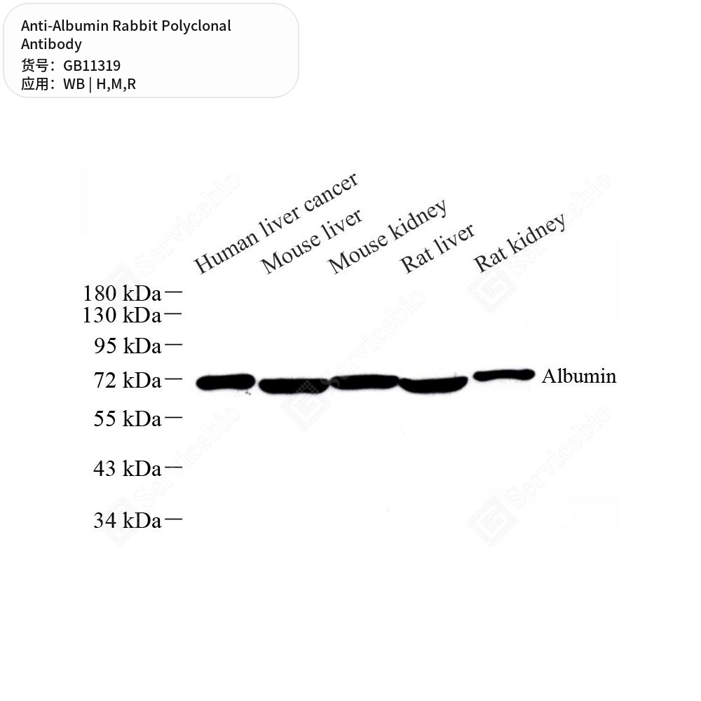 Антитела первичные, поликлональные кролика к Albumin крысы, мыши, человека, 100 мкл