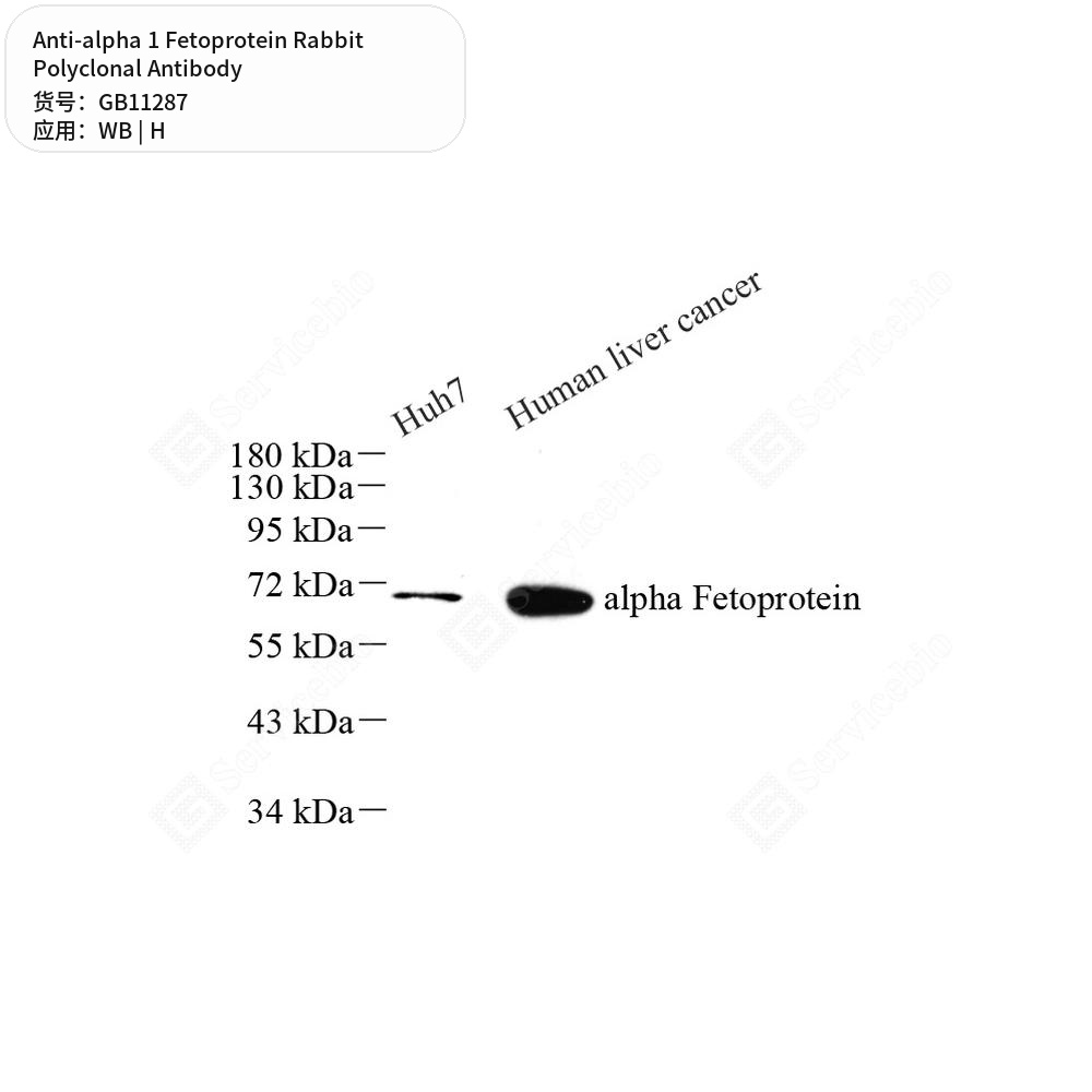 Антитела первичные, поликлональные кролика к alpha 1 Fetoprotein человека, 100 мкл