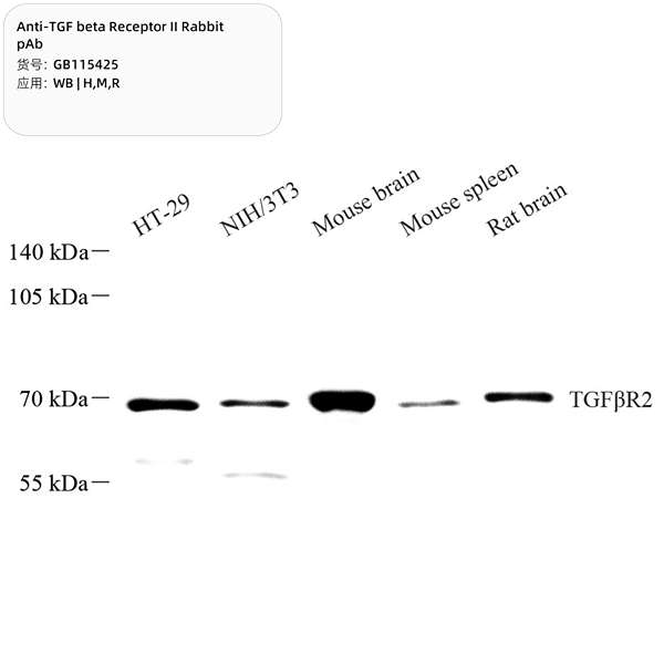 Антитела первичные, поликлональные, TGF beta Receptor II, 100 мкл