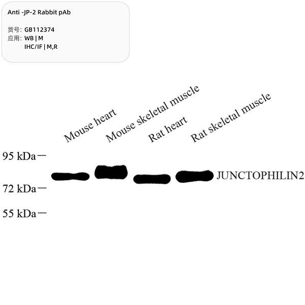 Антитела первичные, поликлональные, JP-2, 100 мкл