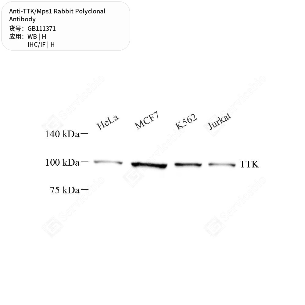 Антитела первичные, поликлональные кролика к TTK/Mps1 человека, 100 мкл
