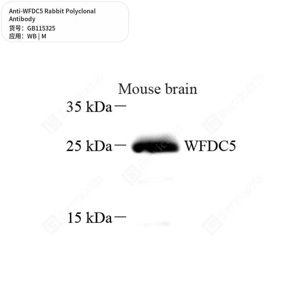 Антитела первичные, поликлональные кролика к WFDC5 мыши, 100 мкл