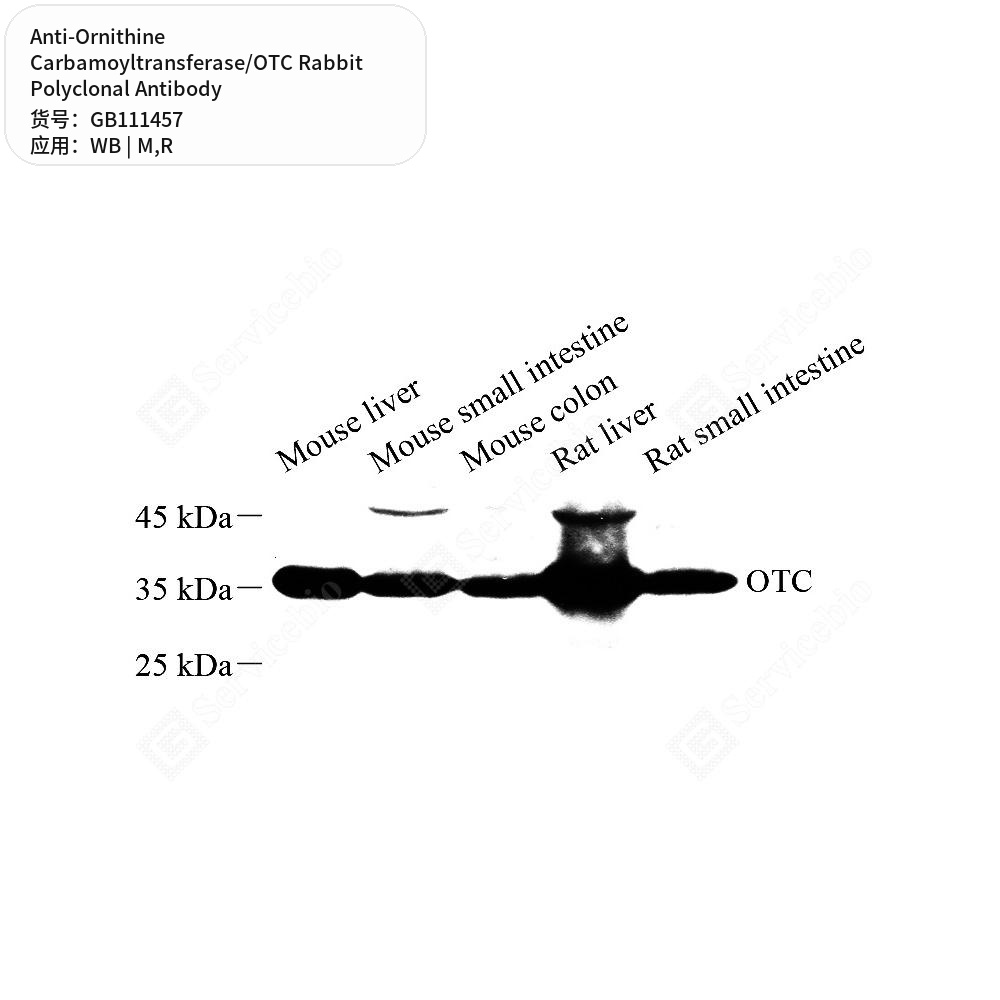 Антитела первичные, поликл. кролика к Ornithine Carbamoyltransferase/OTC крысы, мыши, 100 мкл