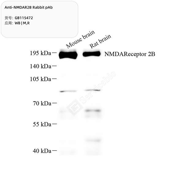 Антитела первичные, поликлональные, NMDAR2B, 100 мкл