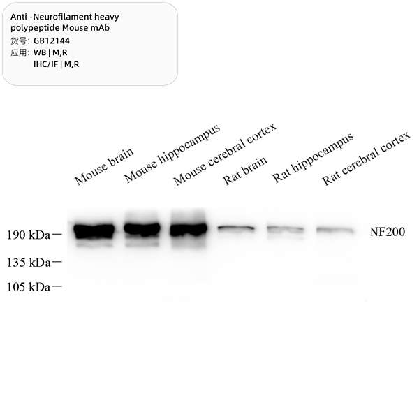 Антитела первичные, моноклональные, Neurofilament heavy polypeptide, 100 мкл