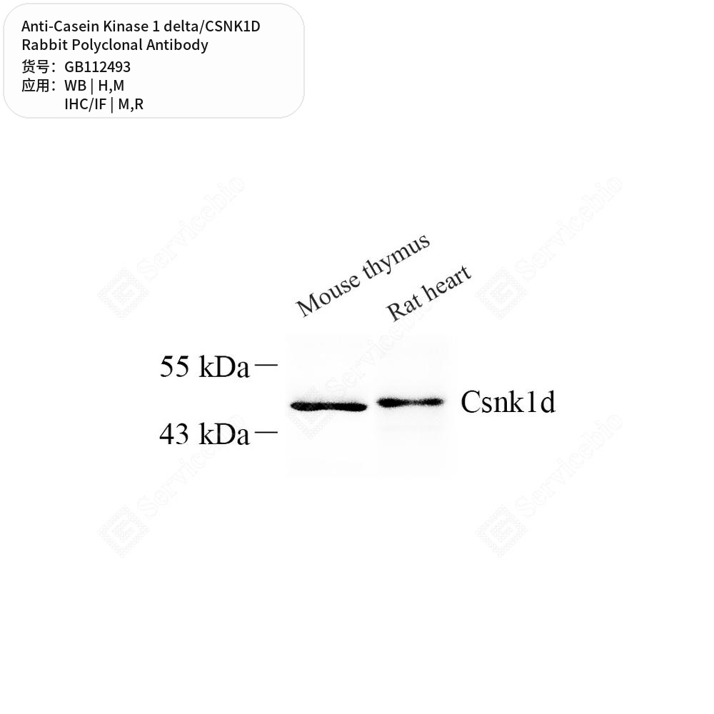 Антитела первичные, поликл. кролика к Casein Kinase 1 delta/CSNK1D крысы, мыши, человека, 100 мкл