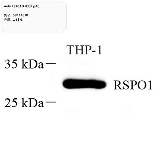 Антитела первичные, поликлональные, RSPO1, 100 мкл