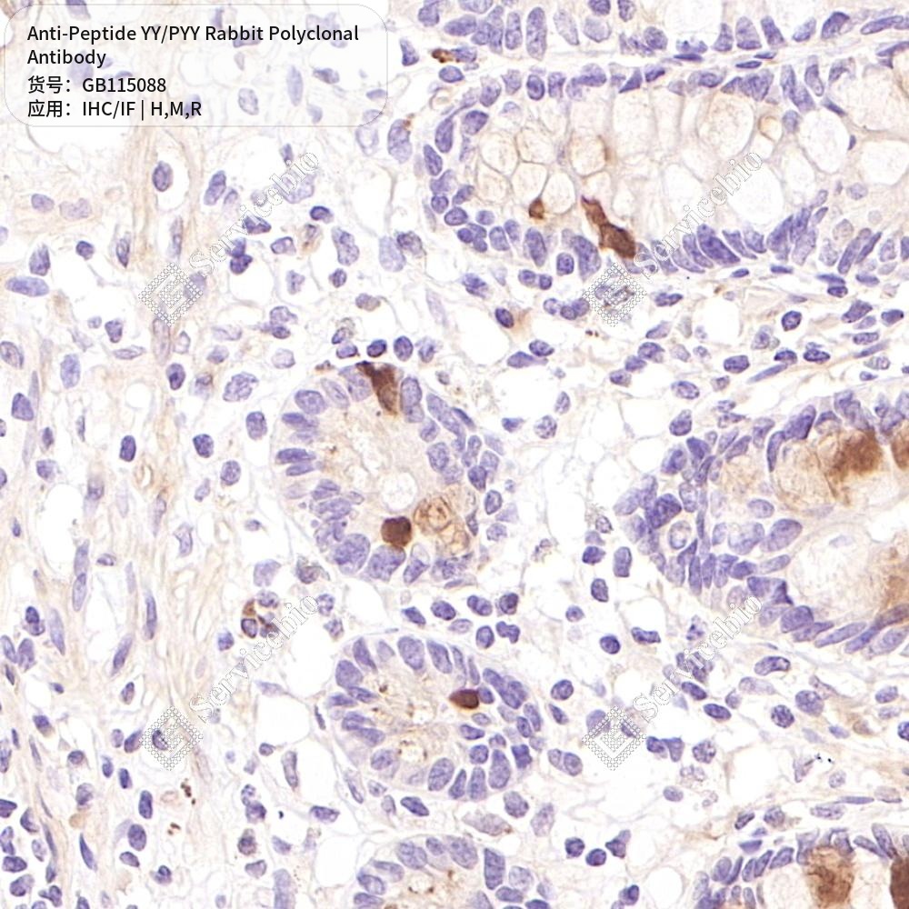 Антитела первичные, поликлональные кролика к Peptide YY/PYY крысы, мыши, человека, 100 мкл