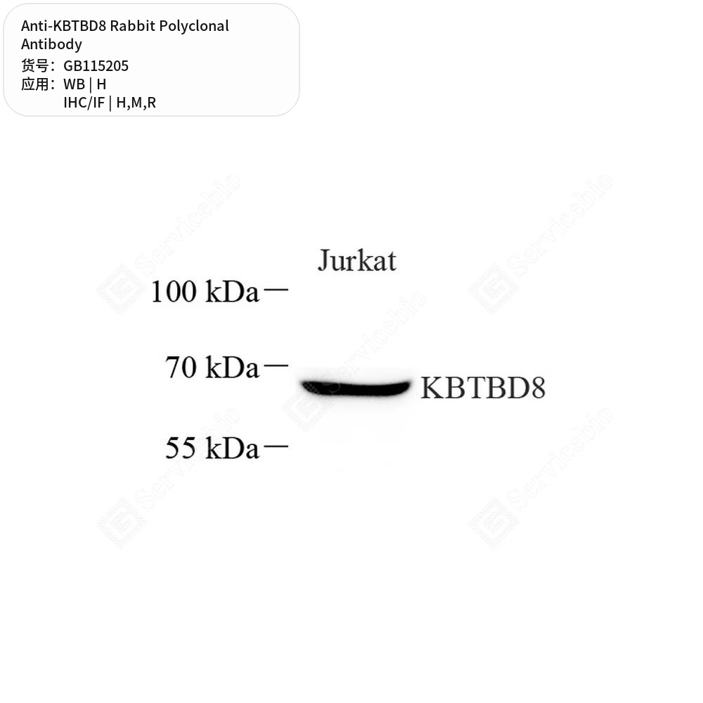 Антитела первичные, поликлональные кролика к KBTBD8 крысы, мыши, человека, 100 мкл