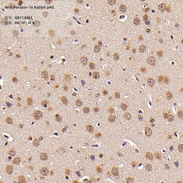 Антитела первичные, поликлональные, Peroxin-16, 100 мкл