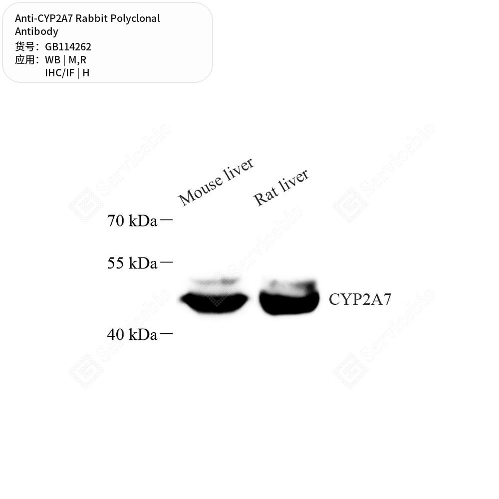 Антитела первичные, поликлональные кролика к CYP2A7 крысы, мыши, человека, 100 мкл