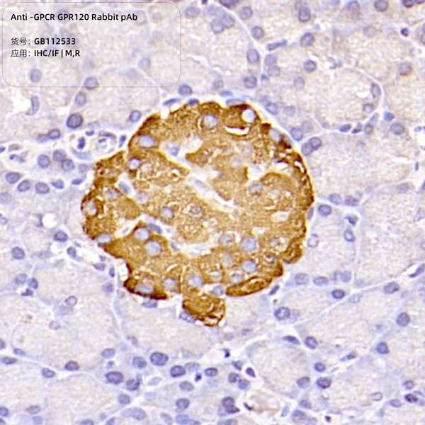 Антитела первичные, поликлональные, GPCR GPR120, 100 мкл