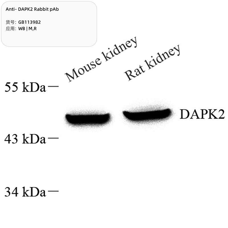Антитела первичные, поликлональные, DAPK2, 100 мкл