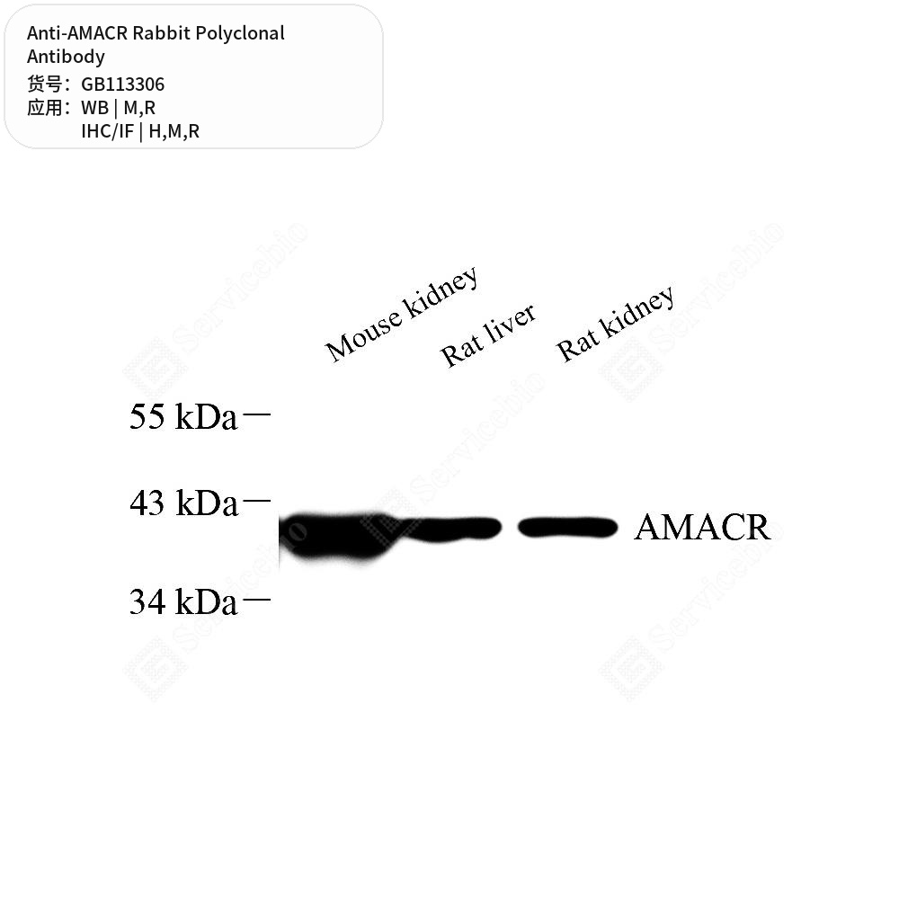 Антитела первичные, поликлональные кролика к AMACR крысы, мыши, человека, 100 мкл