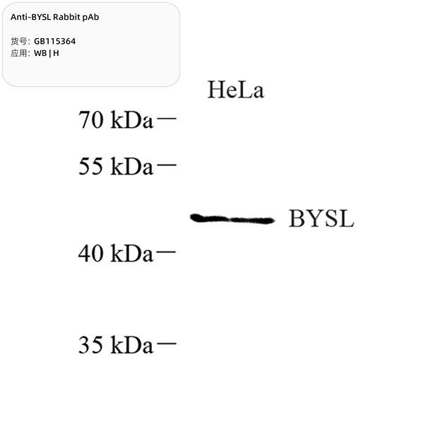 Антитела первичные, поликлональные, BYSL, 100 мкл