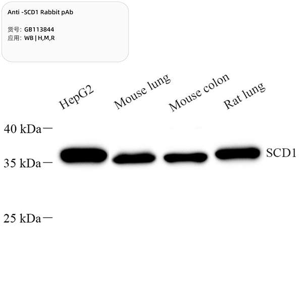 Антитела первичные, поликлональные, SCD1, 100 мкл