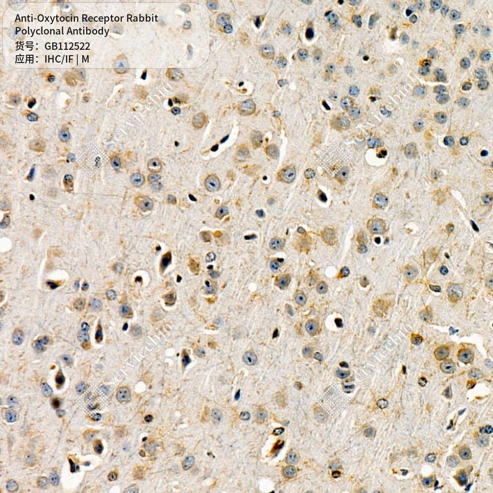 Антитела первичные, поликлональные кролика к Oxytocin Receptor мыши, 100 мкл