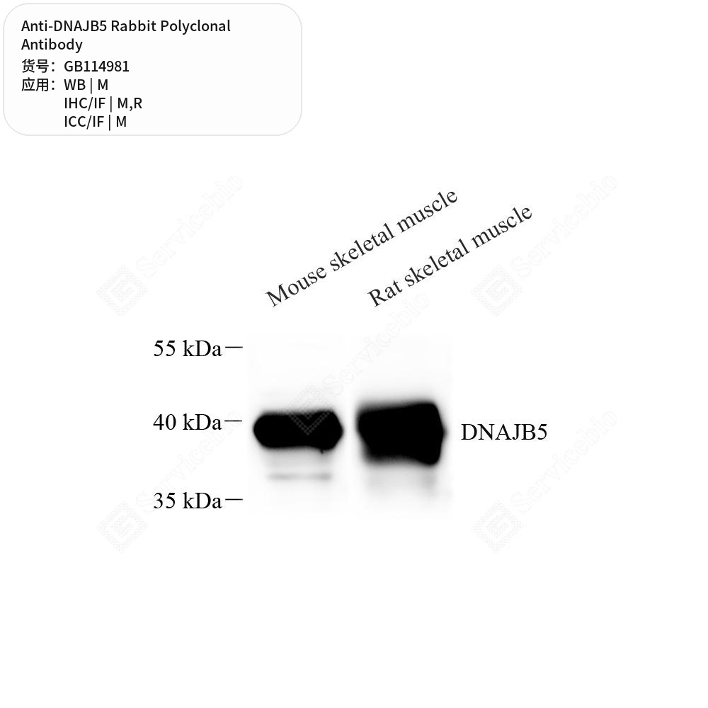 Антитела первичные, поликлональные кролика к DNAJB5 крысы, мыши, 50 мкл