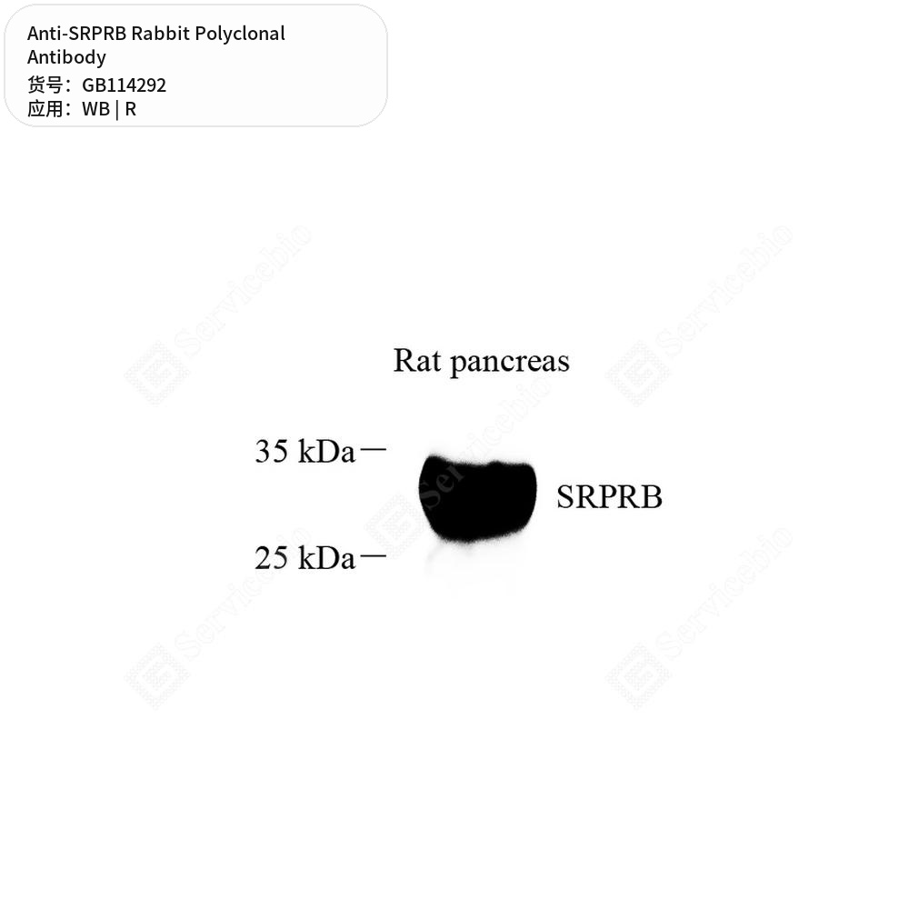 Антитела первичные, поликлональные кролика к SRPRB крысы, 50 мкл