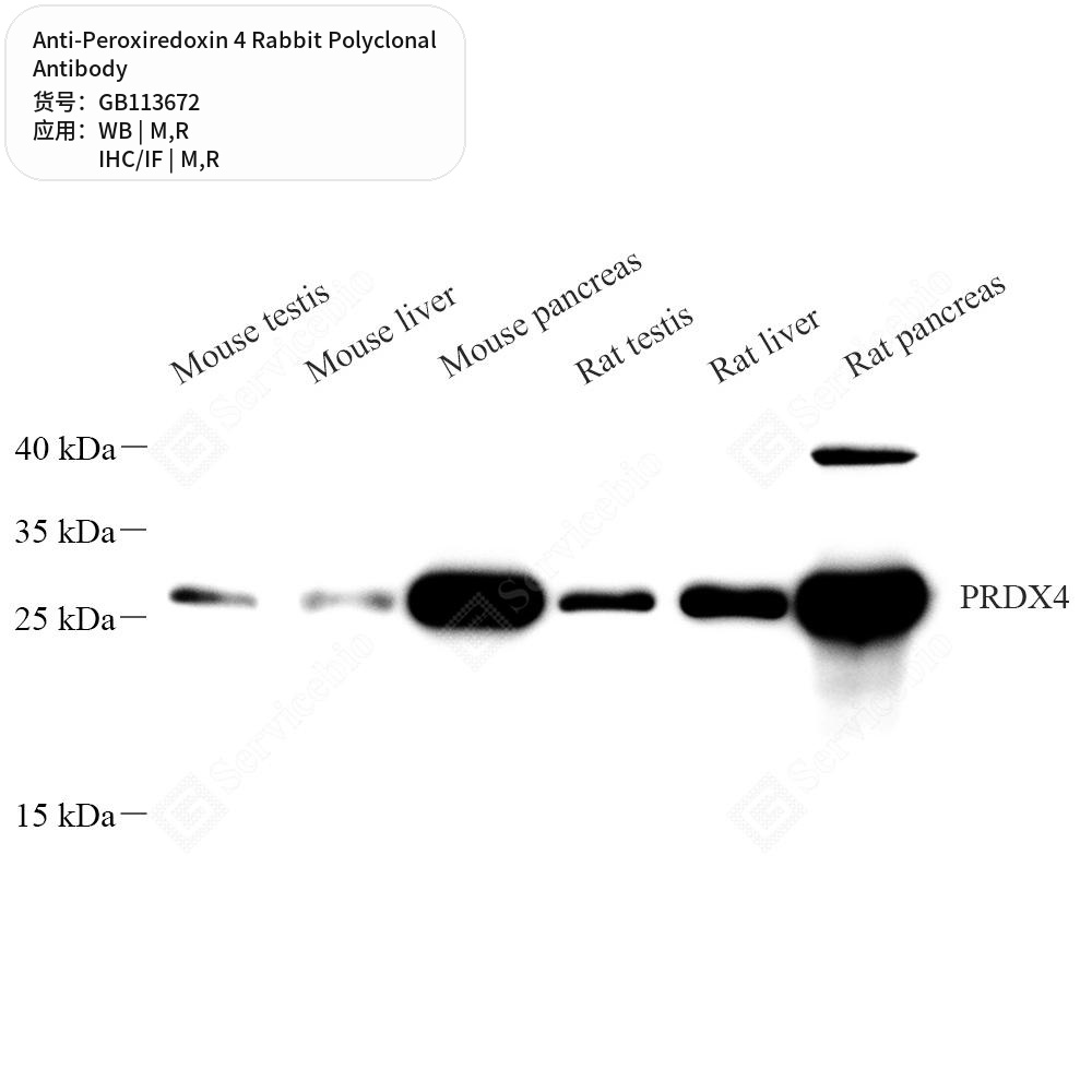 Антитела первичные, поликлональные кролика к Peroxiredoxin 4 крысы, мыши, 50 мкл