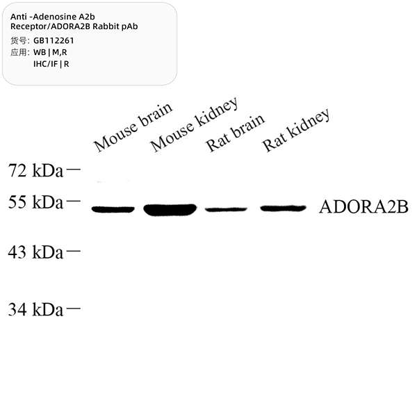 Антитела первичные, поликлональные, Adenosine A2b Receptor/ADORA2B, 100 мкл