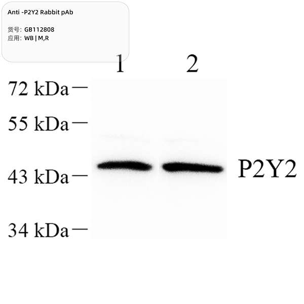 Антитела первичные, поликлональные, P2Y2, 100 мкл