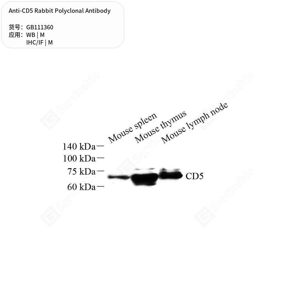 Антитела первичные, поликлональные кролика к CD5 мыши, 50 мкл