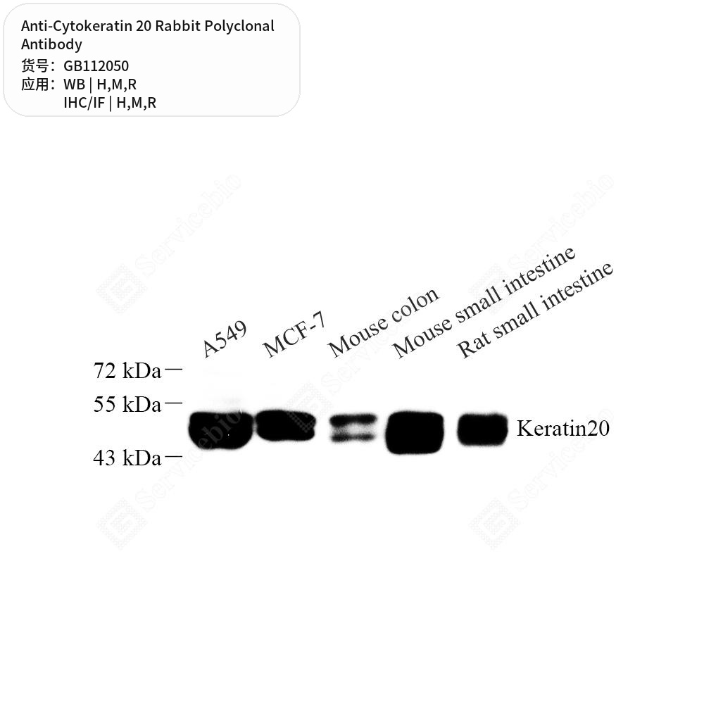 Антитела первичные, поликлональные кролика к Cytokeratin 20 крысы, мыши, человека, 100 мкл