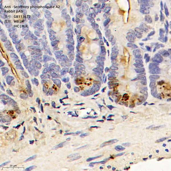 Антитела первичные, поликлональные, Secretory phospholipase A2, 100 мкл