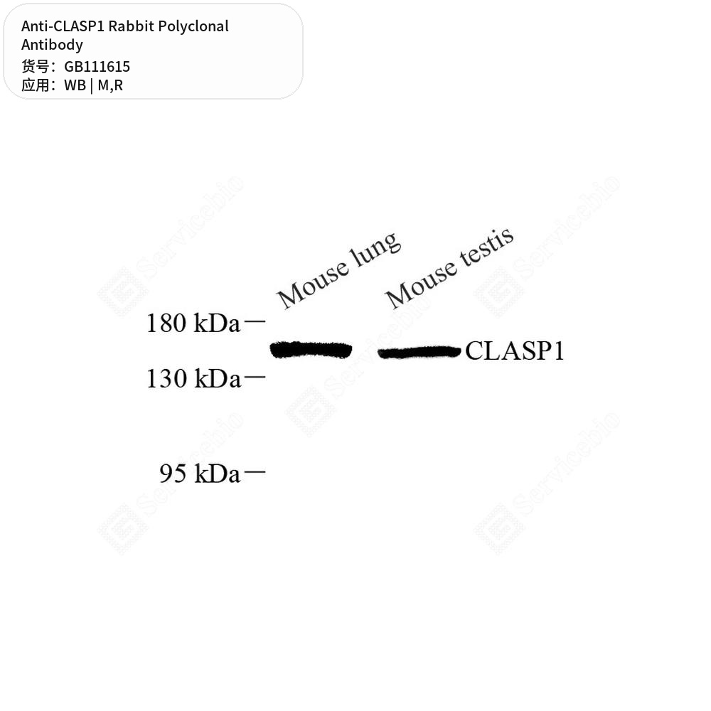 Антитела первичные, поликлональные кролика к CLASP1 крысы, мыши, 100 мкл
