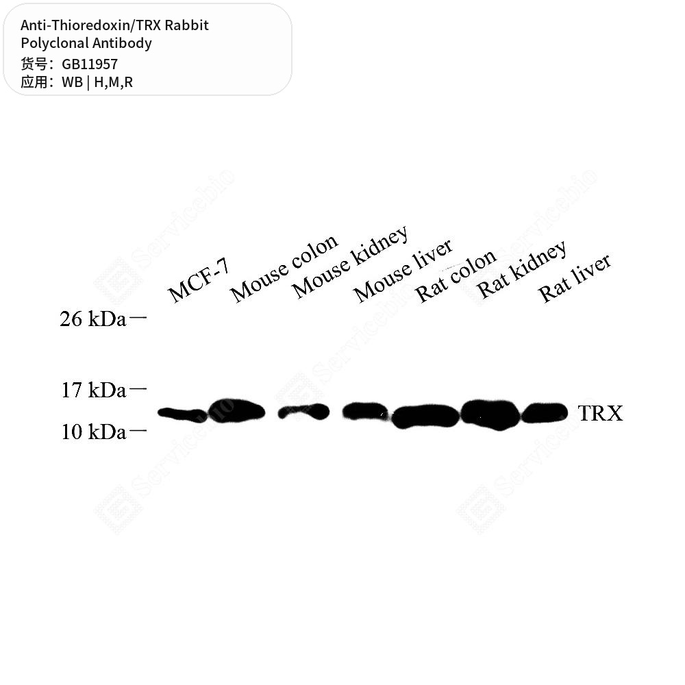 Антитела первичные, поликлональные кролика к Thioredoxin/TRX крысы, мыши, человека, 50 мкл