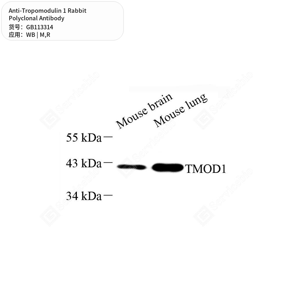 Антитела первичные, поликлональные кролика к Tropomodulin 1 крысы, мыши, 100 мкл