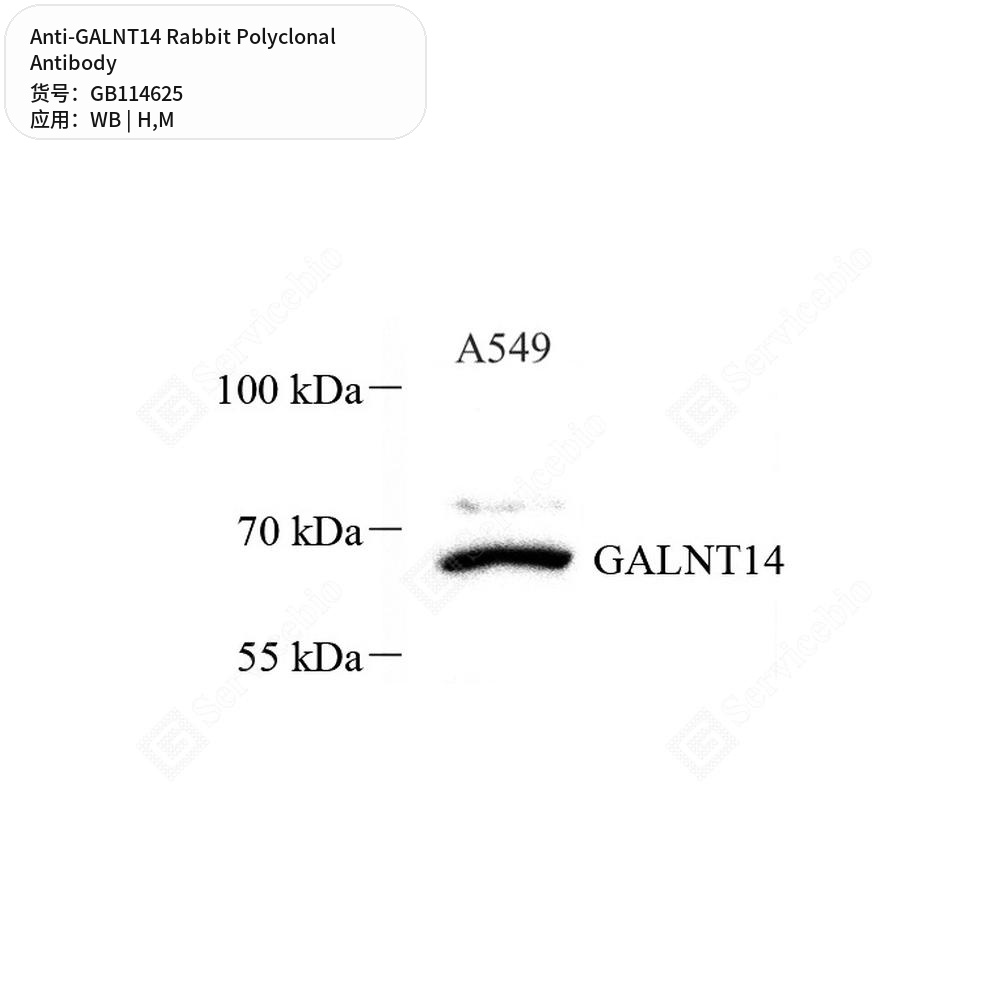 Антитела первичные, поликлональные кролика к GALNT14 мыши, человека, 50 мкл