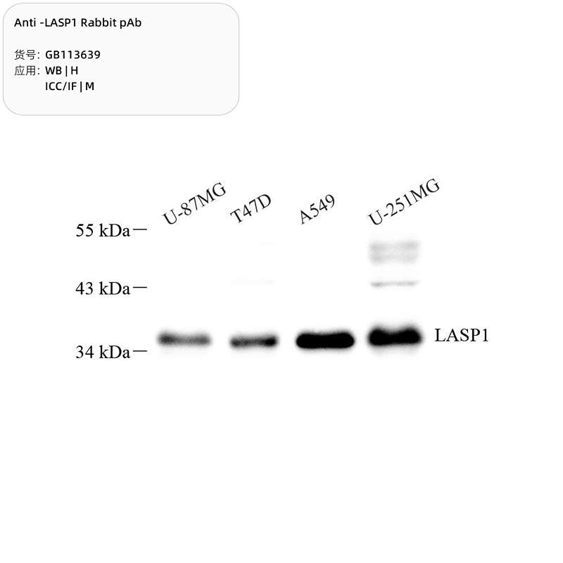 Антитела первичные, поликлональные, LASP1, 100 мкл