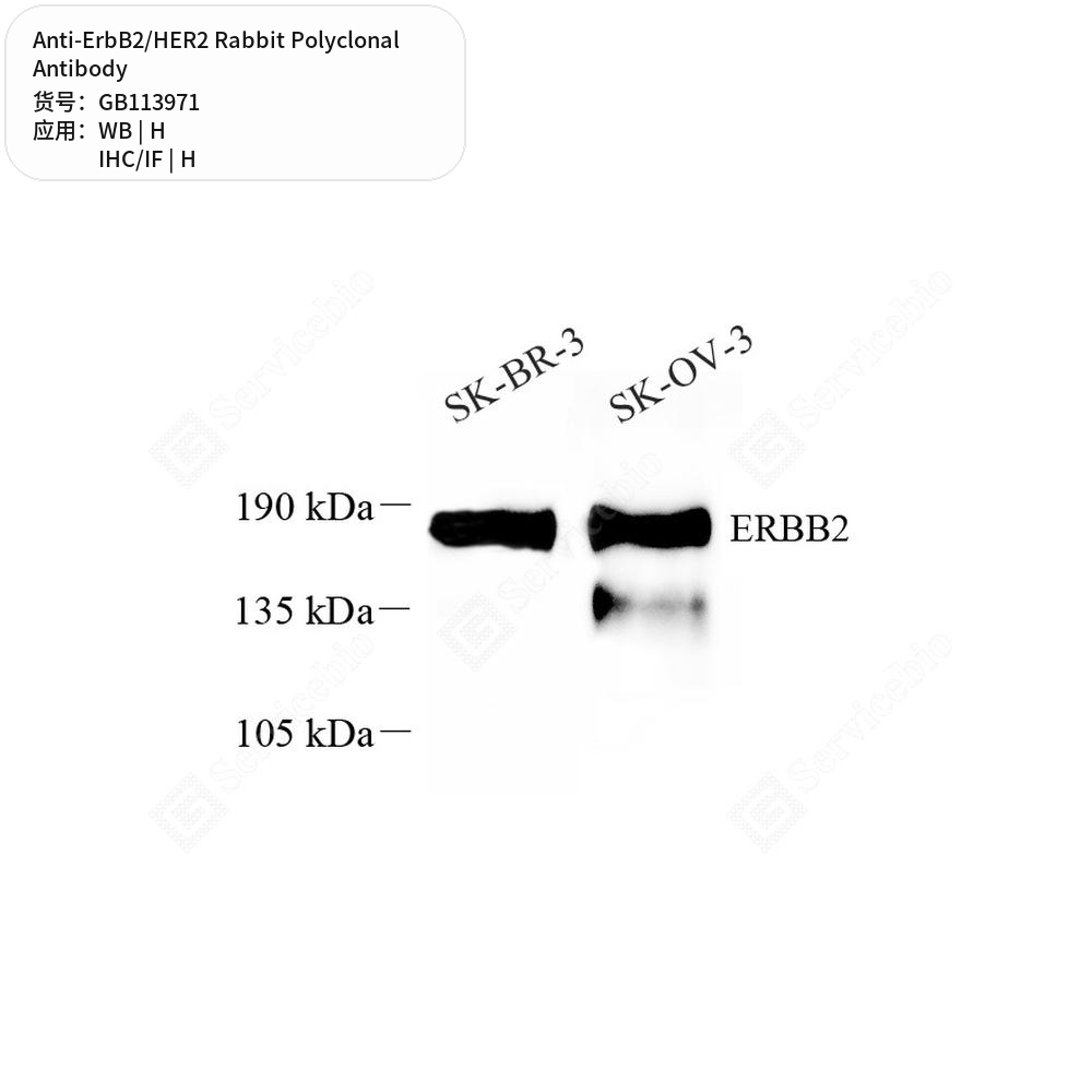 Антитела первичные, поликлональные кролика к ErbB2/HER2 человека, 50 мкл