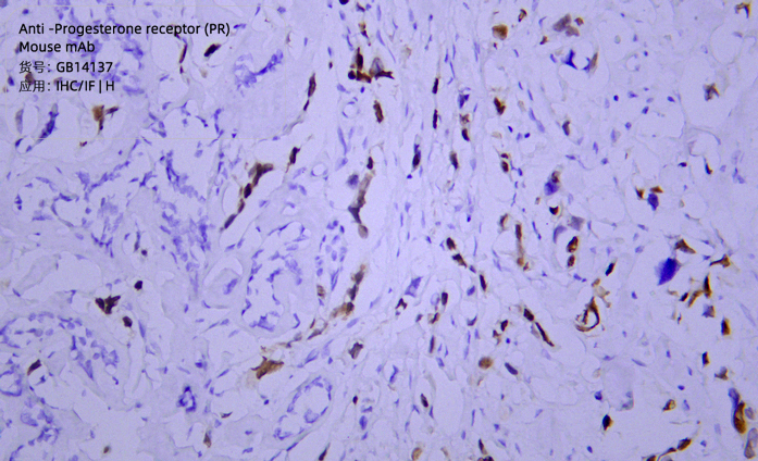 Антитела первичные, моноклональные мыши к Progesterone receptor (PR) человека, 50 мкл
