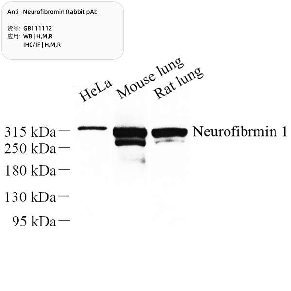 Антитела первичные, поликлональные, Neurofibromin, 100 мкл