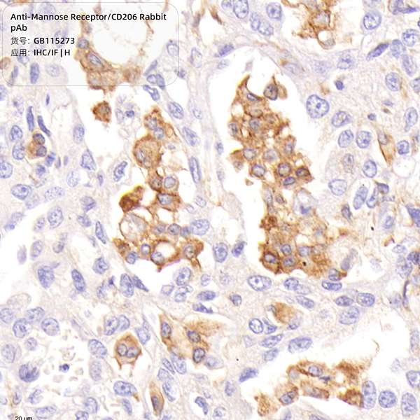 Антитела первичные, поликлональные, Mannose Receptor/CD206, 100 мкл