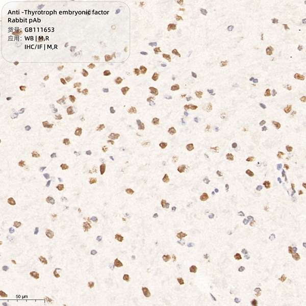 Антитела первичные, поликлональные, Thyrotroph embryonic factor, 100 мкл