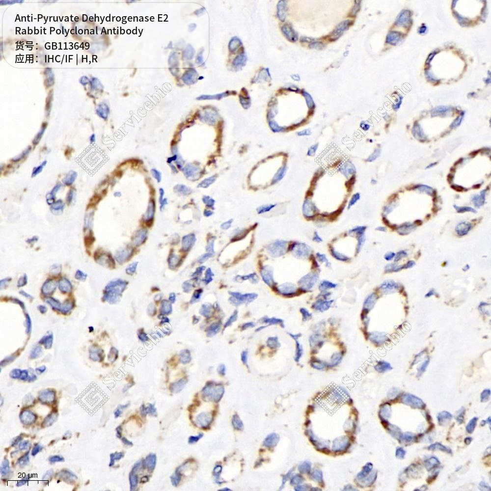 Антитела первичные, поликлональные кролика к Pyruvate Dehydrogenase E2 крысы, человека, 100 мкл