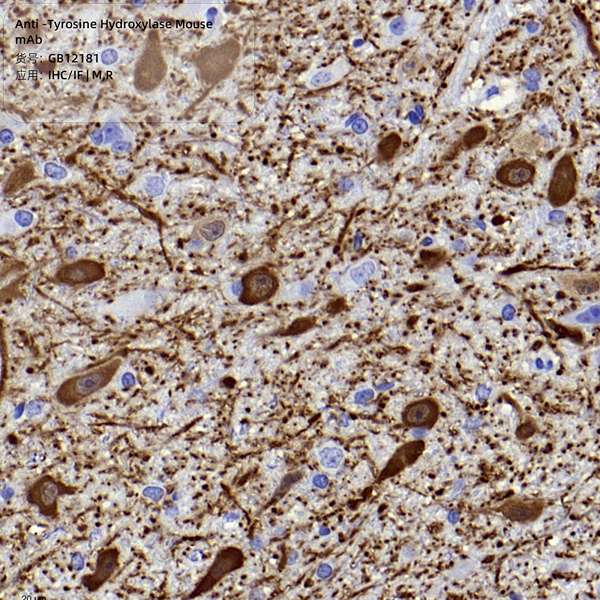 Антитела первичные, моноклональные, Tyrosine Hydroxylase, 100 мкл